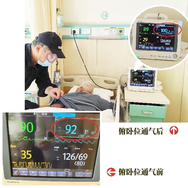 俯卧位通气.jpg 俯卧位通气.jpg