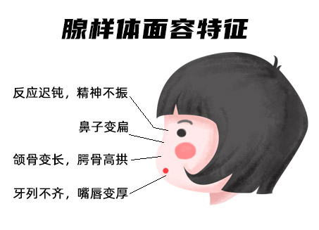 腺样体面容.jpg